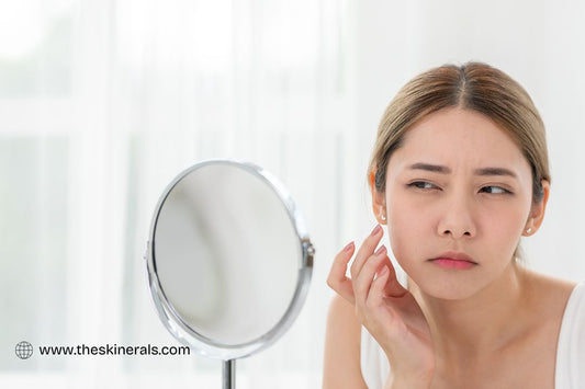 Types of Pimples and Acne Understanding Differences for Effective Treatment theSkinerals
